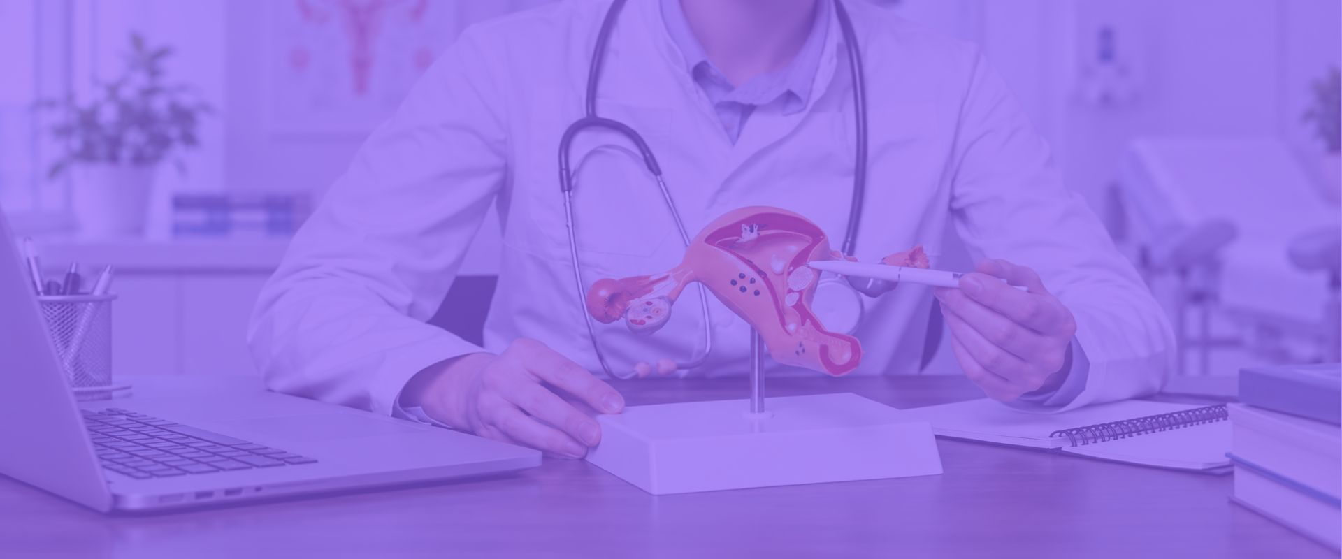 Médico de jaleco branco segurando um modelo anatômico de útero com mioma sobre mesa de escritório com laptop e caderno, ambiente clínico, tom roxo translúcido sobreposto, fotografia profissional realista